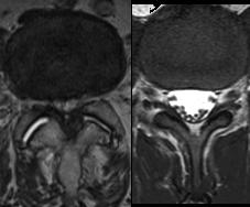 bild_3_wirbelsaeulenchirurgie3_13513