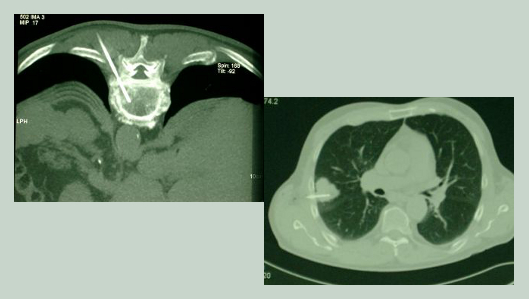 Klinik für Radiologie